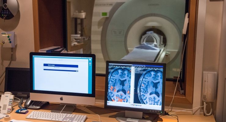 Call for Participants – Multimodal Study of Concussion in Sport